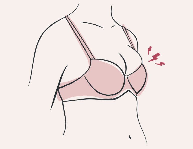 Strategies for Lifting and Providing Support to Side Set Breasts